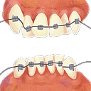 dental retainer Slack emoji