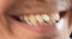 image5 Slack emoji